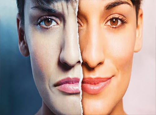 اختلال دوقطبي